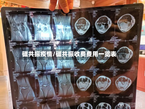 磁共振疫情/磁共振收费费用一览表