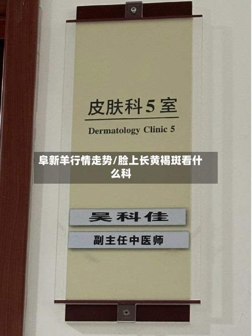 阜新羊行情走势/脸上长黄褐斑看什么科