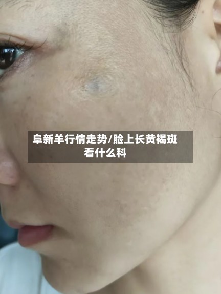 阜新羊行情走势/脸上长黄褐斑看什么科-第3张图片