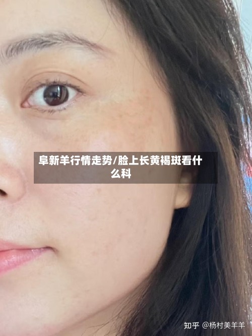 阜新羊行情走势/脸上长黄褐斑看什么科-第2张图片